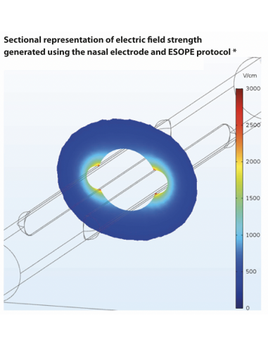 2 x Nasal electrodes, Ø 4mm (pack of 2 units)
